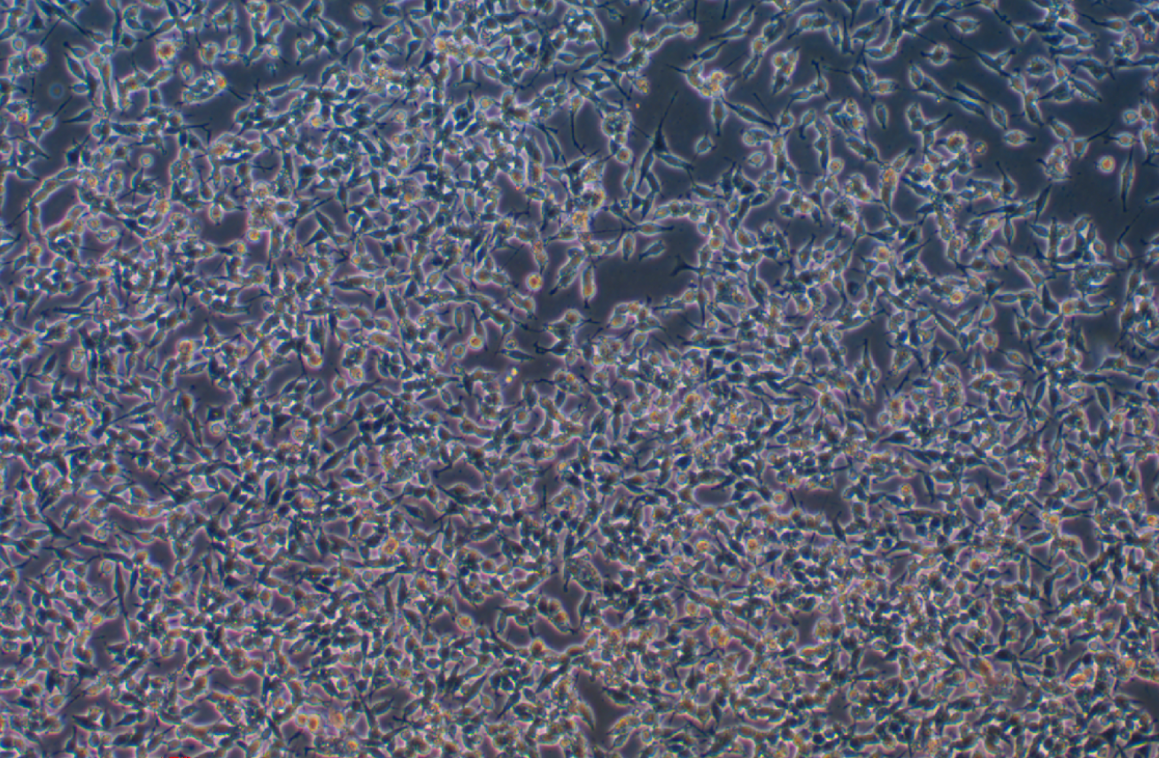 人神經(jīng)母細(xì)胞瘤細(xì)胞 NB1 (STR鑒定正確)