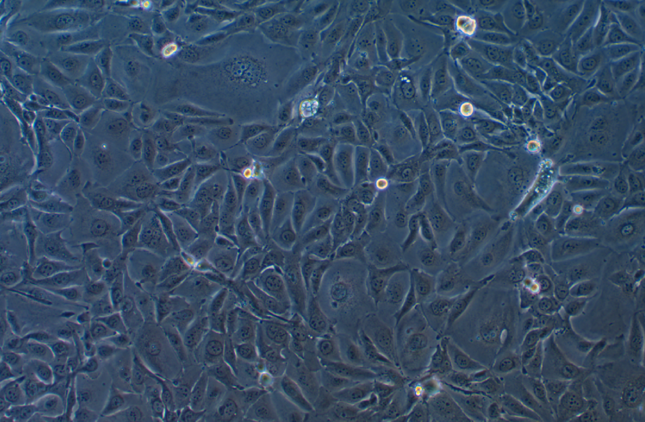 人肺腺癌細胞NCI-H3255(STR鑒定正確)