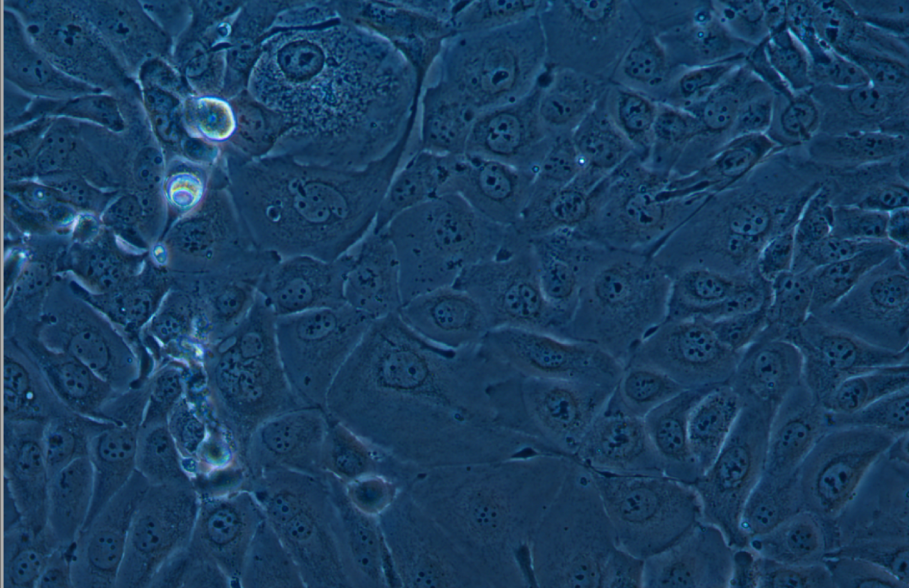 人肺腺癌細胞NCI-H3255(STR鑒定正確)
