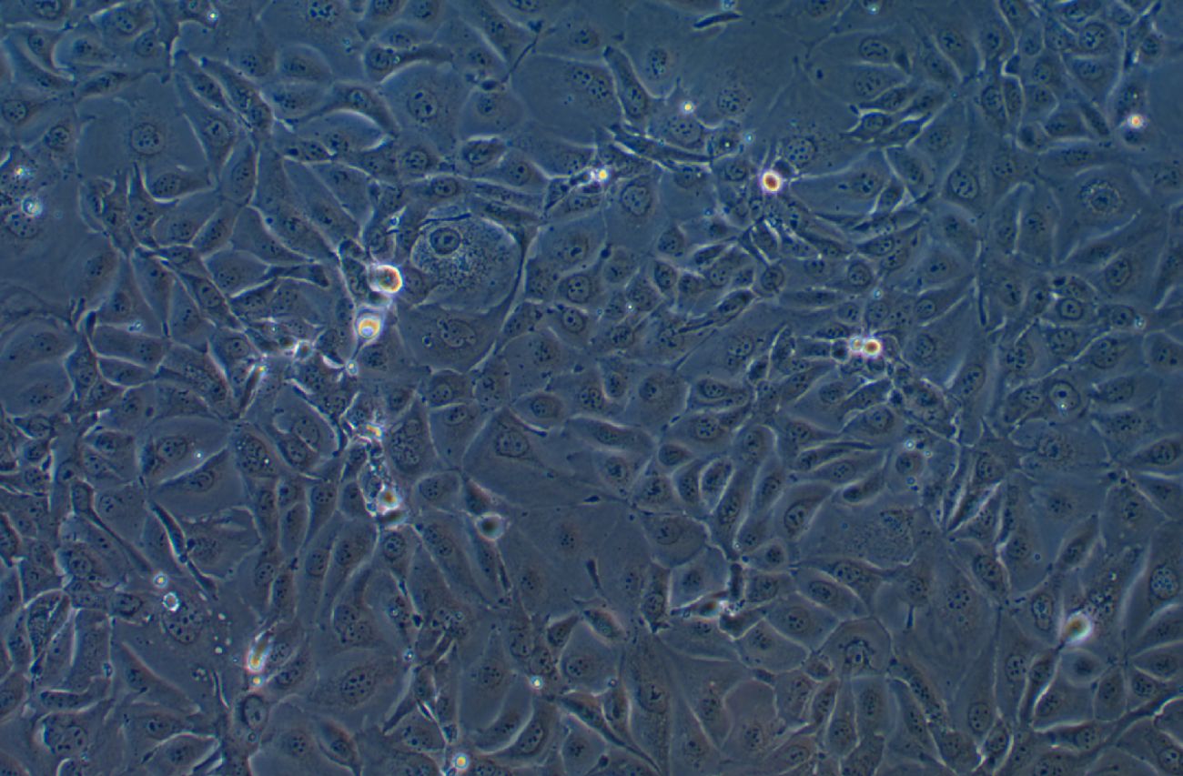 人肺腺癌細胞NCI-H3255(STR鑒定正確)