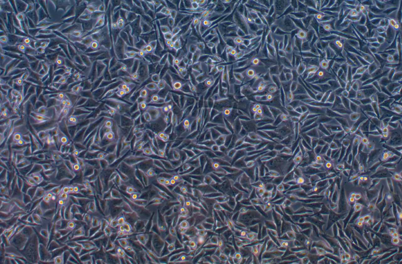 人骨髓橫紋肌肉癌細胞SJCRH30(STR鑒定正確)
