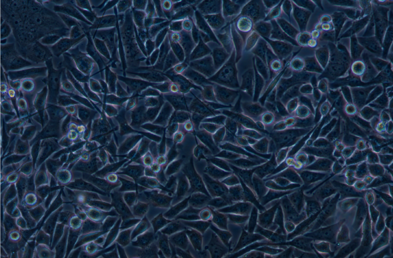 人骨髓橫紋肌肉癌細胞SJCRH30(STR鑒定正確)