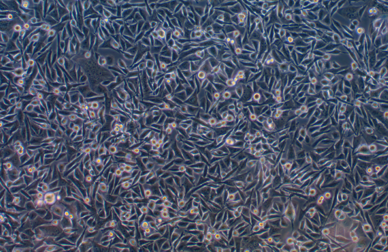 人骨髓橫紋肌肉癌細胞SJCRH30(STR鑒定正確)