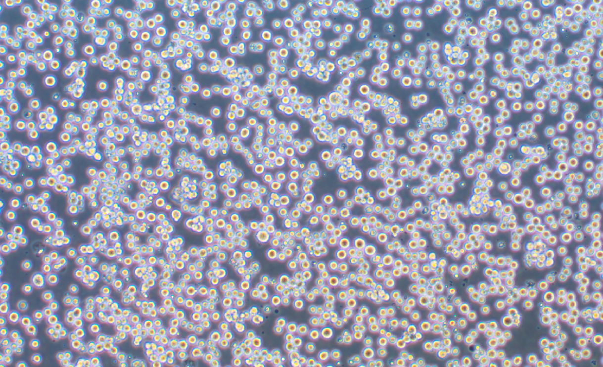 人胃癌細胞SNU-1(STR鑒定正確)