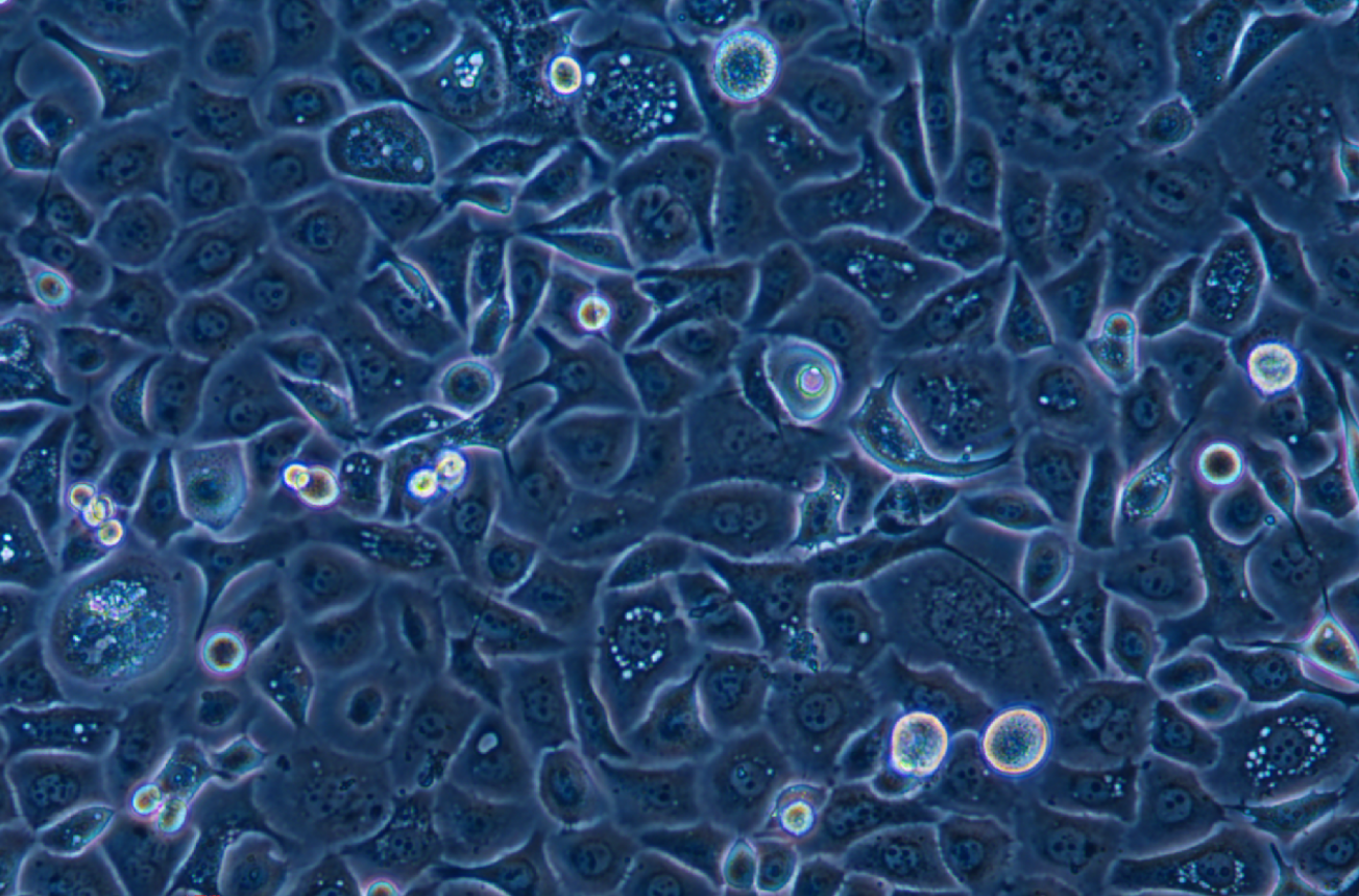 人子宮頸表皮癌細胞ME-180(STR鑒定正確)