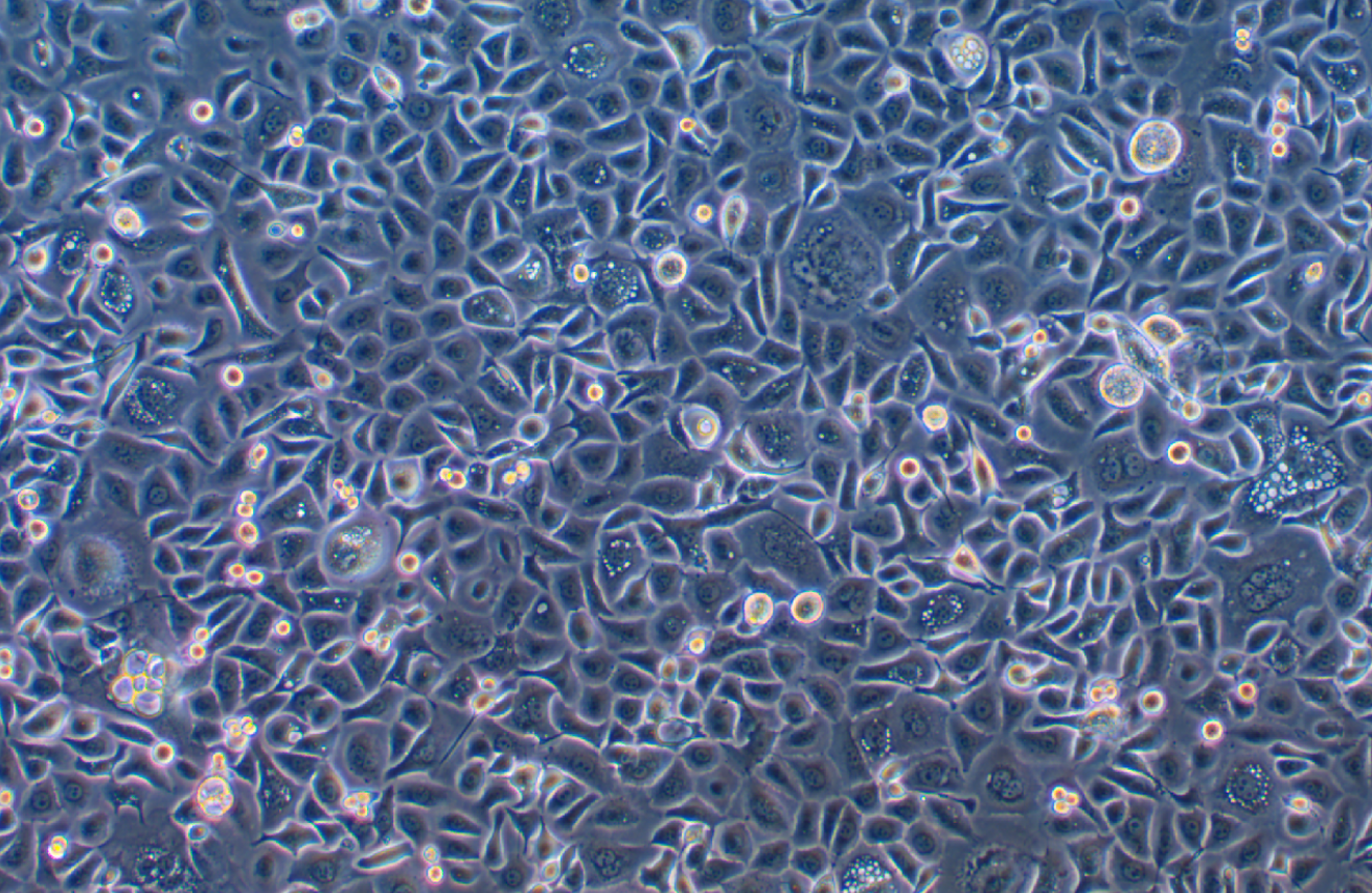 人子宮頸表皮癌細胞ME-180(STR鑒定正確)