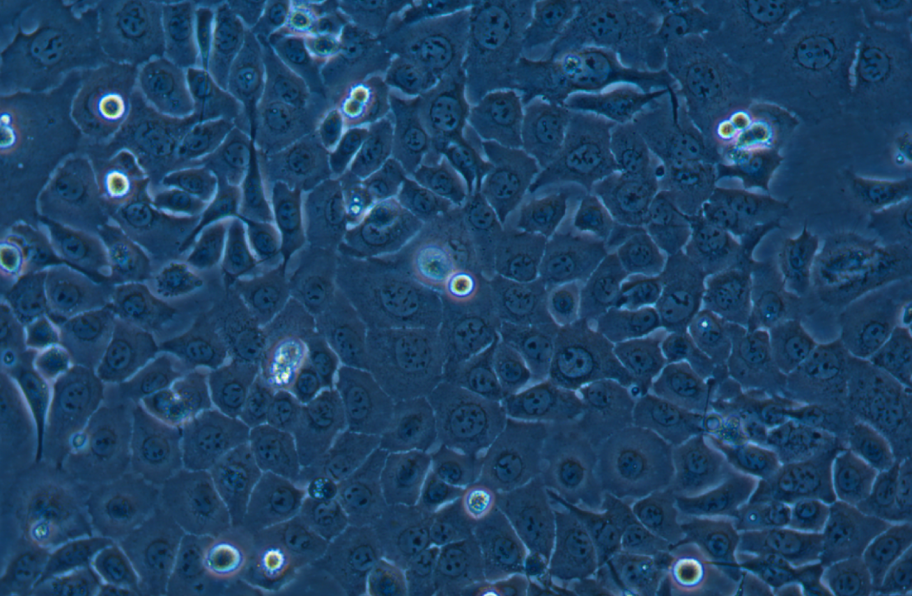 人食管癌細(xì)胞TE-1(STR鑒定正確)