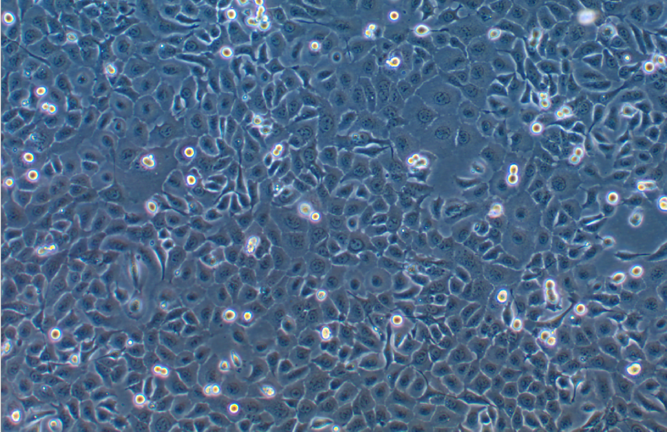 人食管癌細(xì)胞TE-1(STR鑒定正確)