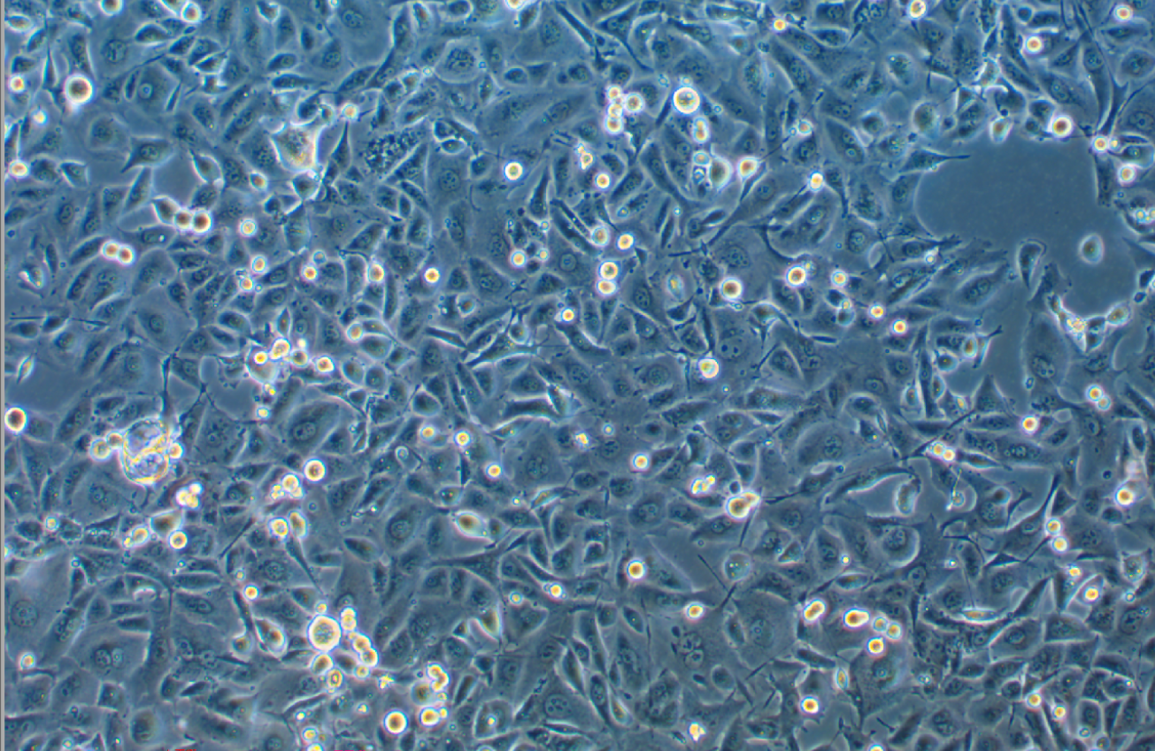 人非小細胞肺癌奧希替尼耐藥株HCC-827+Osimertinib (STR鑒定正確)