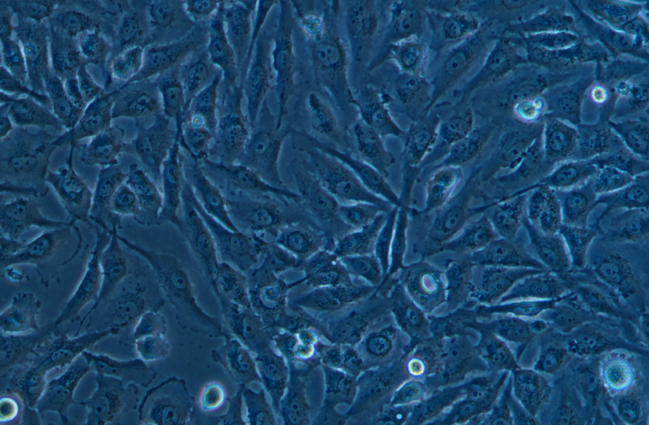 人神經膠質細胞瘤細胞U251 (STR鑒定正確)