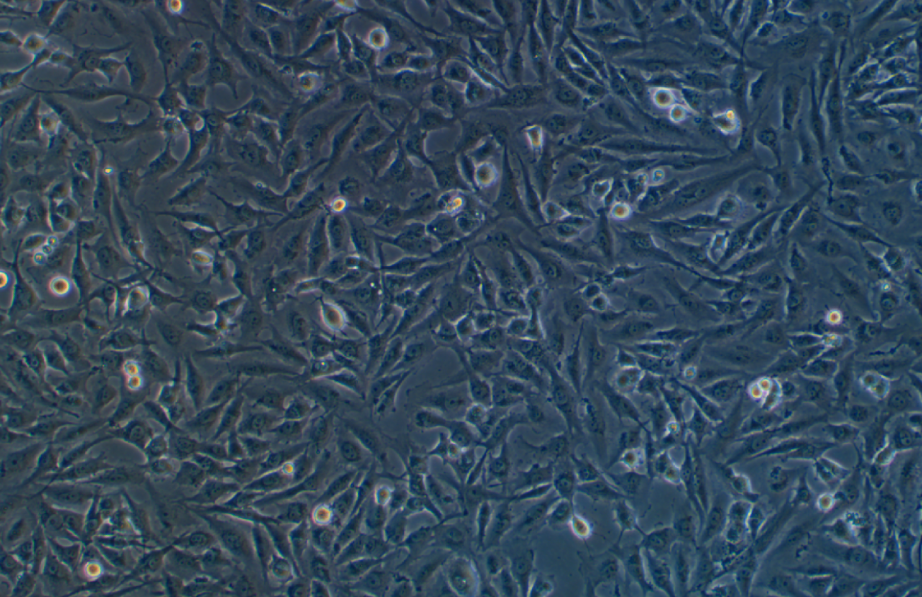人神經膠質細胞瘤細胞U251 (STR鑒定正確)