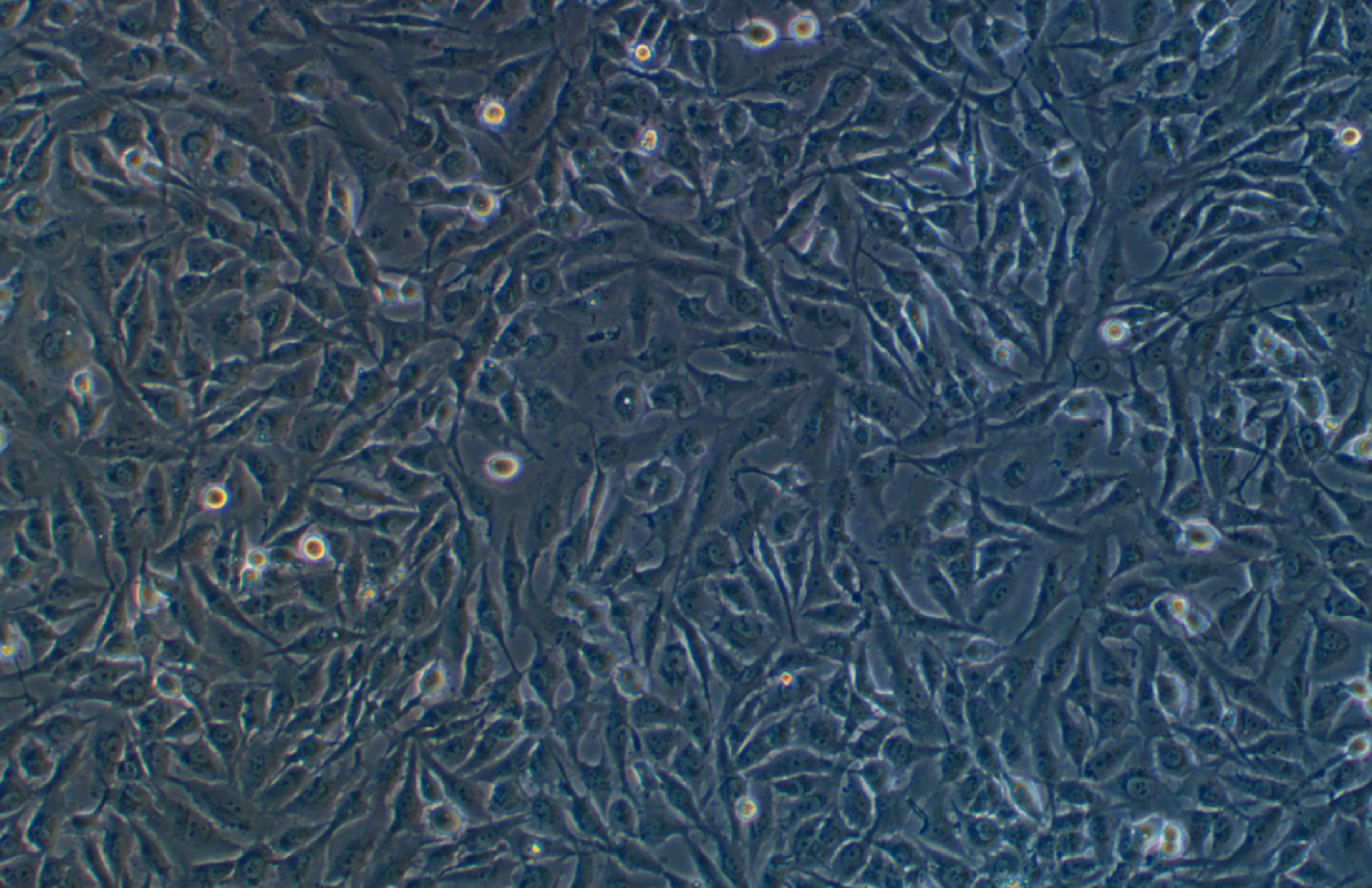 人神經膠質細胞瘤細胞U251 (STR鑒定正確)