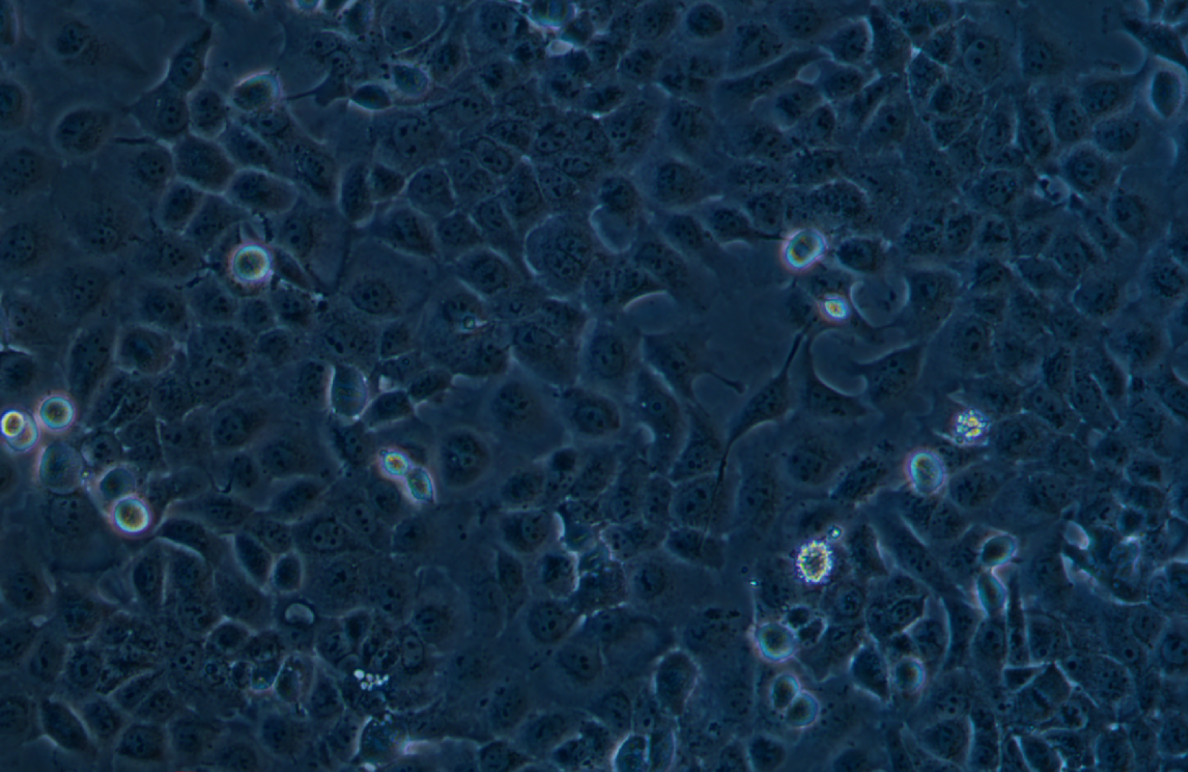 人宮頸癌腸轉移細胞Ca Ski(STR鑒定正確)