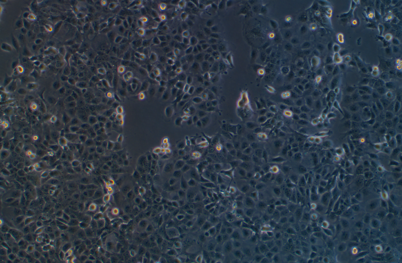 人宮頸癌腸轉移細胞Ca Ski(STR鑒定正確)