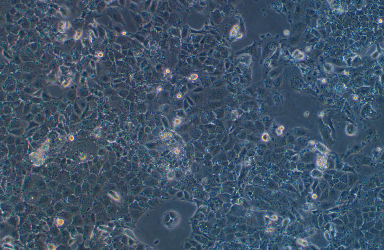 人卵巢癌細胞OV-90(STR鑒定正確)
