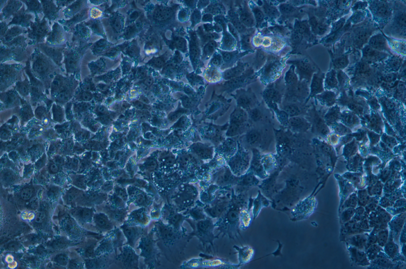 人卵巢癌細胞OV-90(STR鑒定正確)