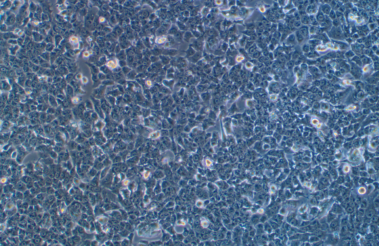 小鼠肝癌細(xì)胞Hepa 1-6(種屬鑒定)