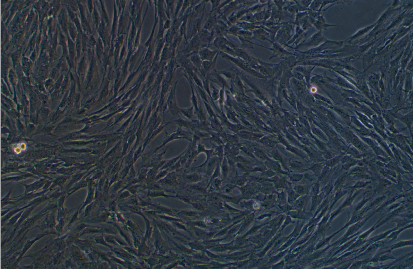 人視網膜muller細胞