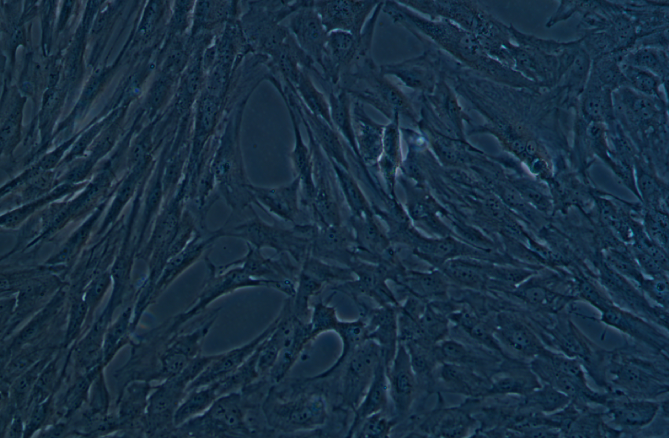 人視網膜muller細胞