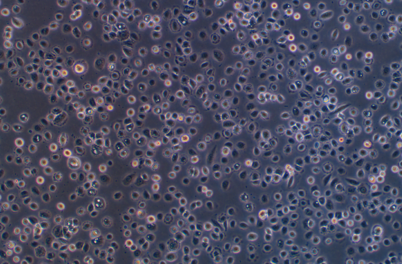 人陰道上皮細胞VK2/E6E7(STR鑒定正確)