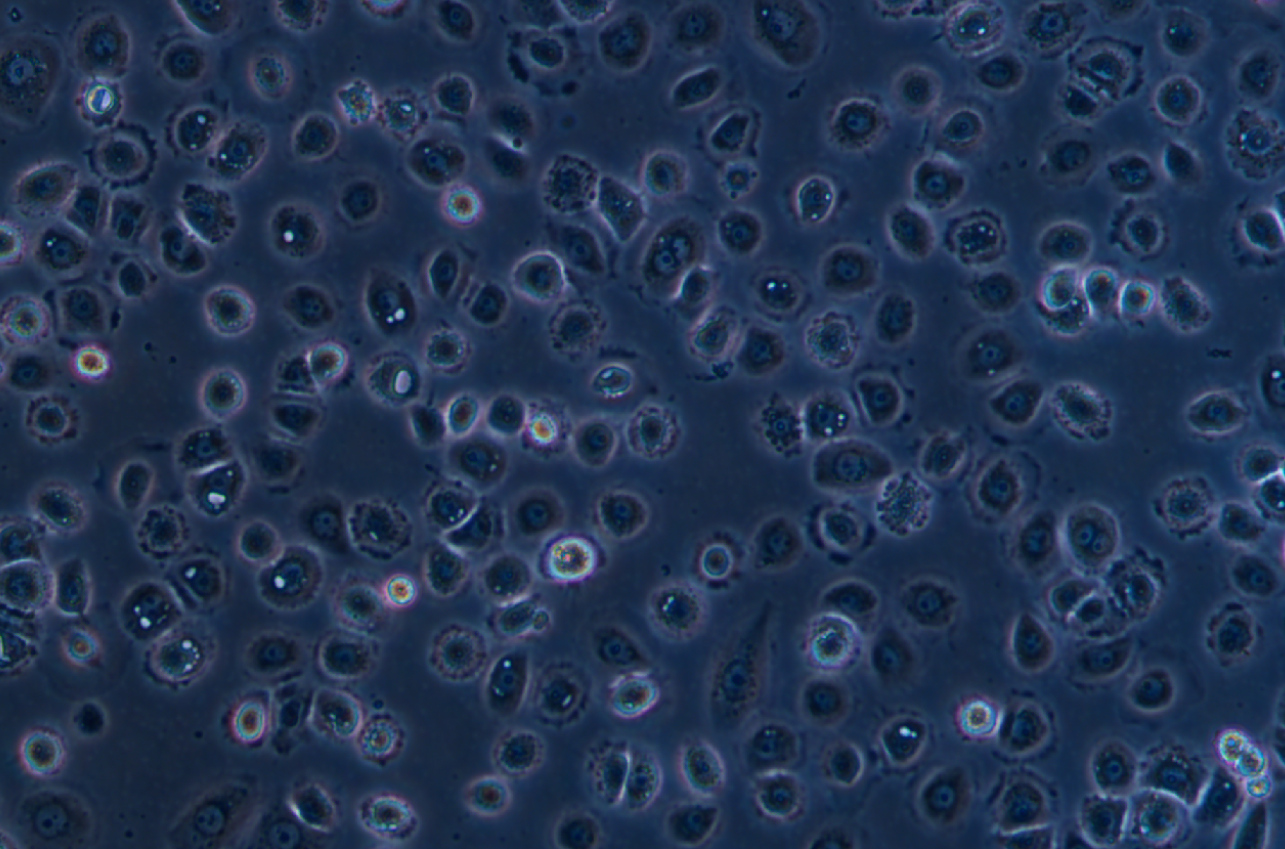 人陰道上皮細胞VK2/E6E7(STR鑒定正確)
