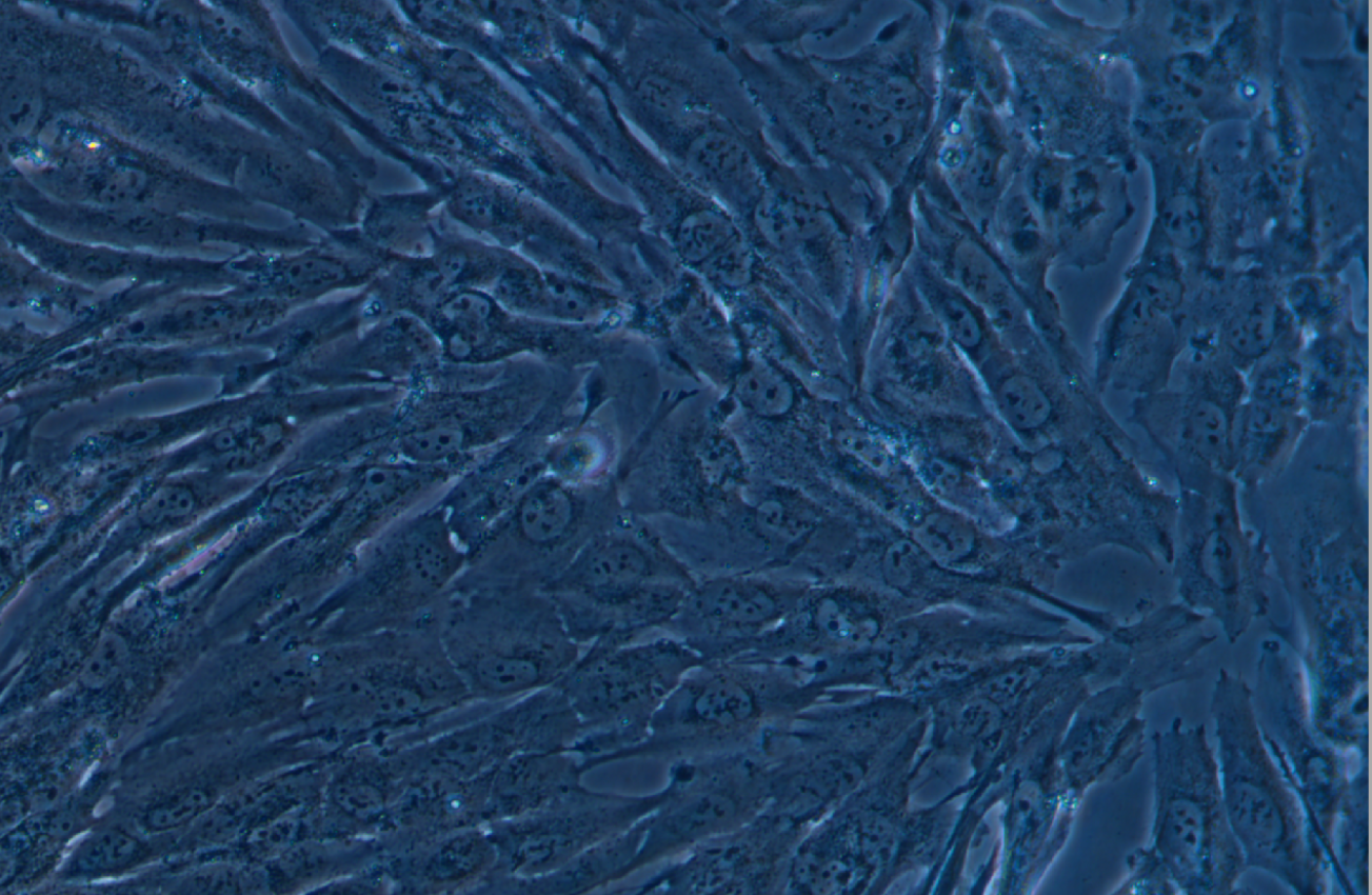 人膠質(zhì)瘤細胞TJ905 (STR鑒定正確)