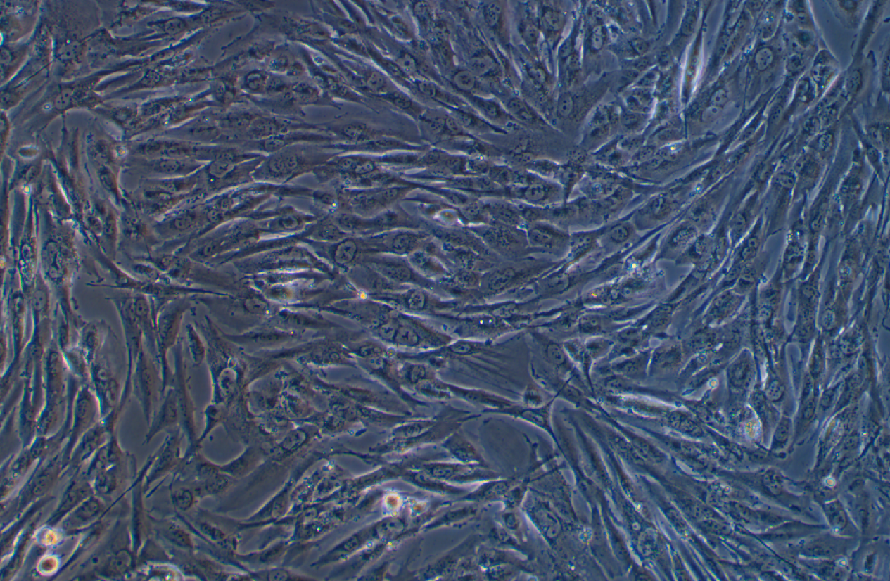 人膠質(zhì)瘤細胞TJ905 (STR鑒定正確)