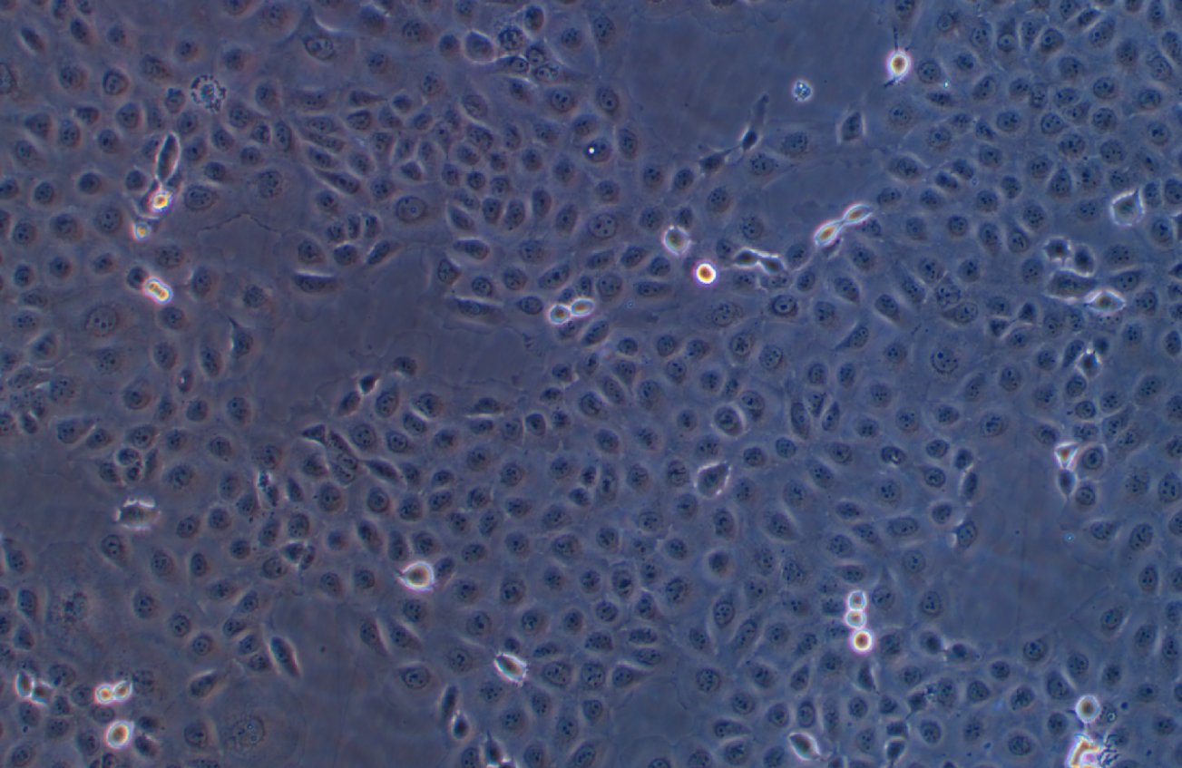 人舌鱗癌細胞WSU-HN6 (STR鑒定正確)