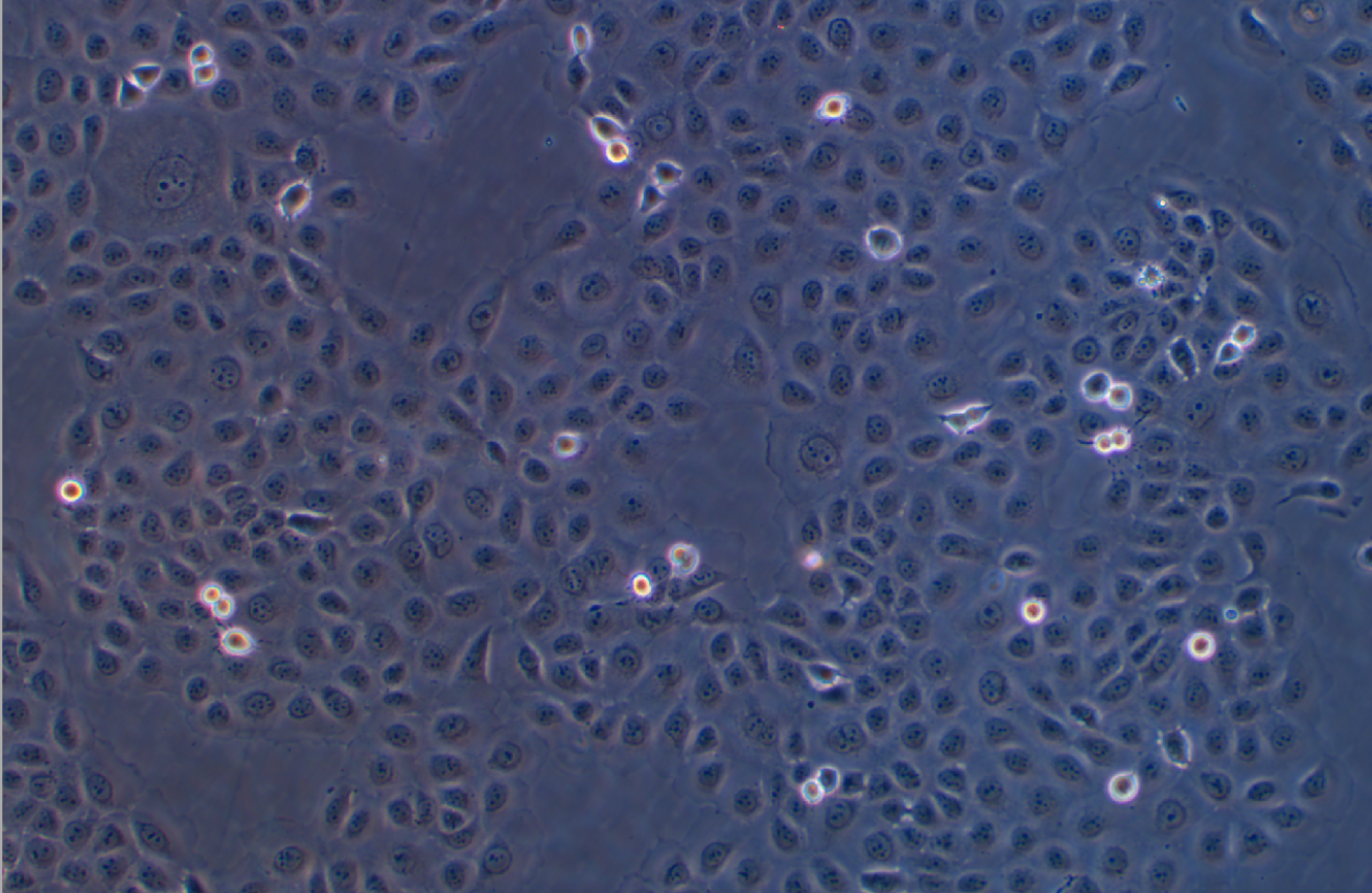 人舌鱗癌細胞WSU-HN6 (STR鑒定正確)
