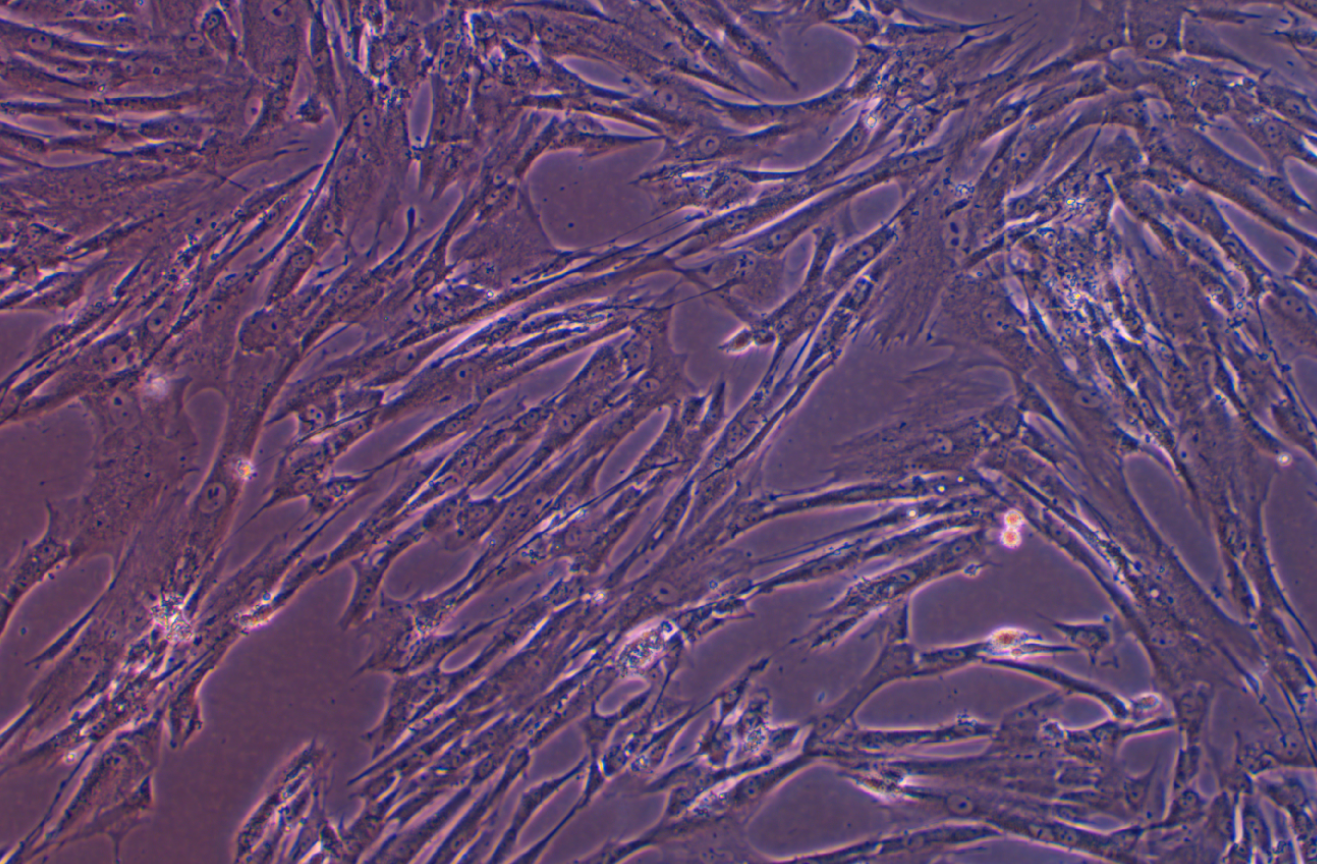 人胚肝二倍體細(xì)胞 CCC-HEL-1(STR鑒定正確)