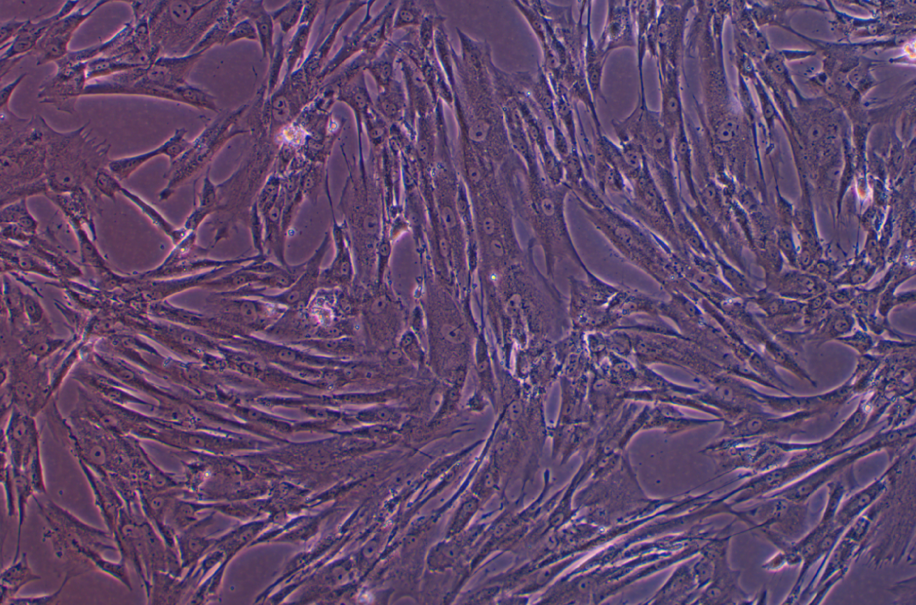 人胚肝二倍體細(xì)胞 CCC-HEL-1(STR鑒定正確)