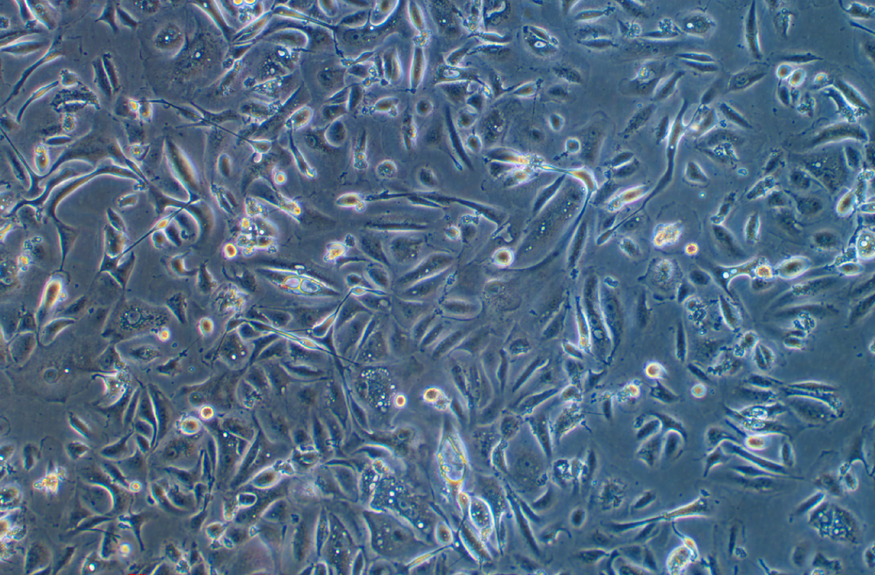 人附睪管上皮細胞