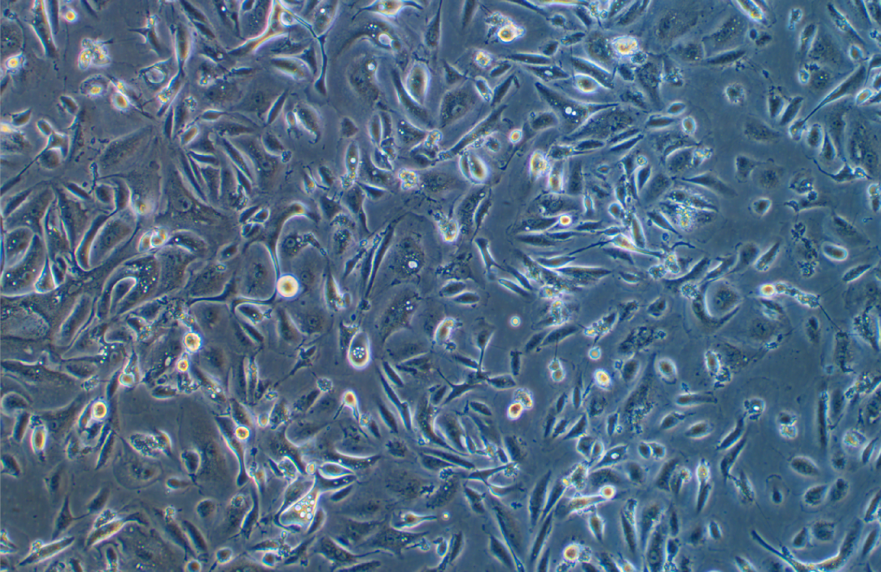 人附睪管上皮細胞