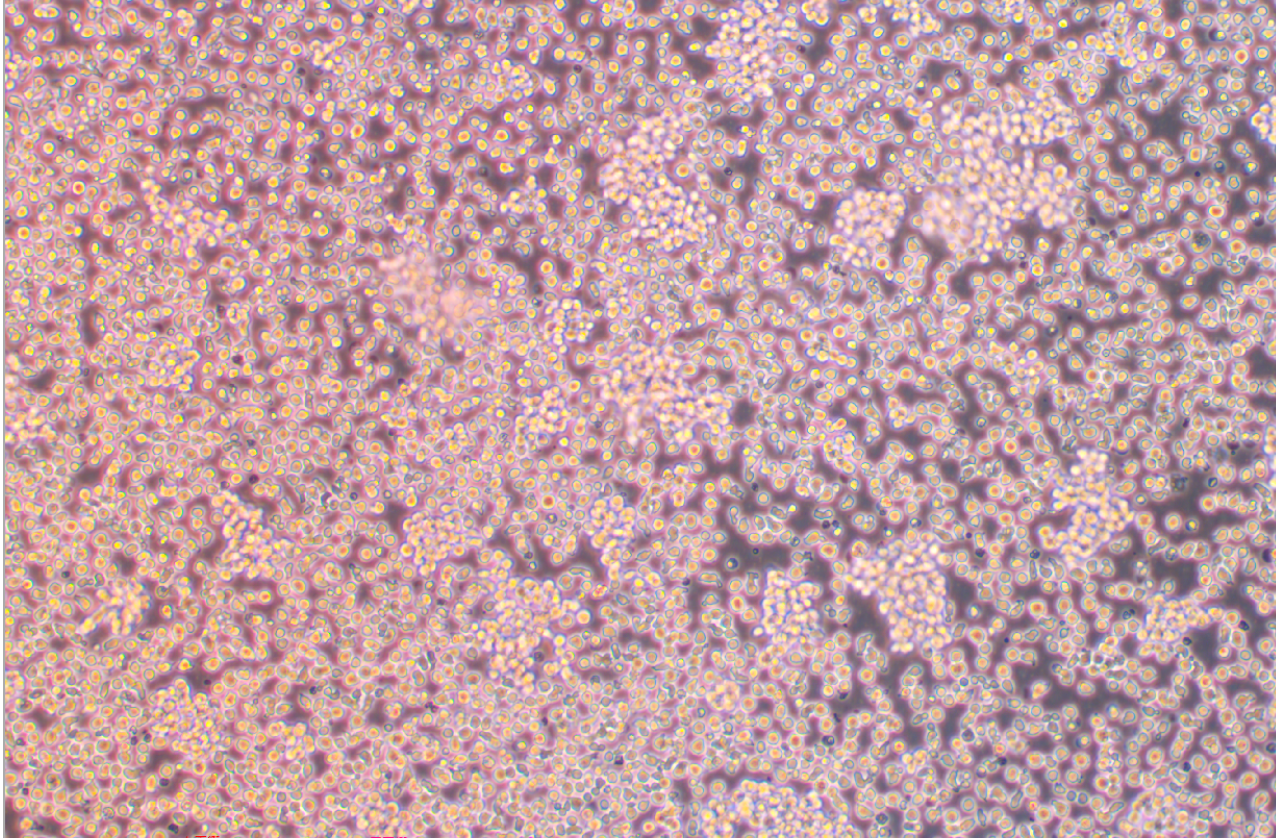 人B細胞淋巴瘤細胞U2932(STR鑒定正確)