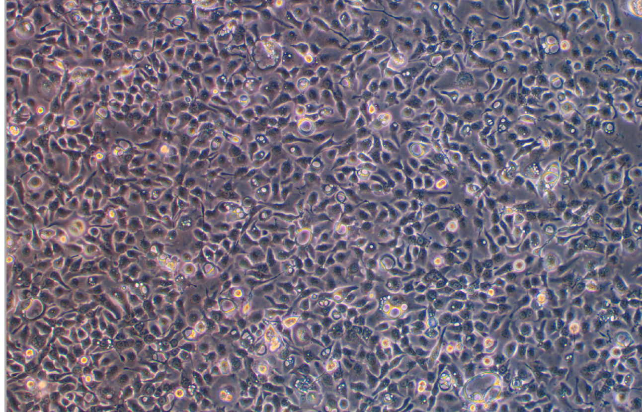人子宮內膜異位癥上皮細胞End1/E6E7(STR鑒定正確)