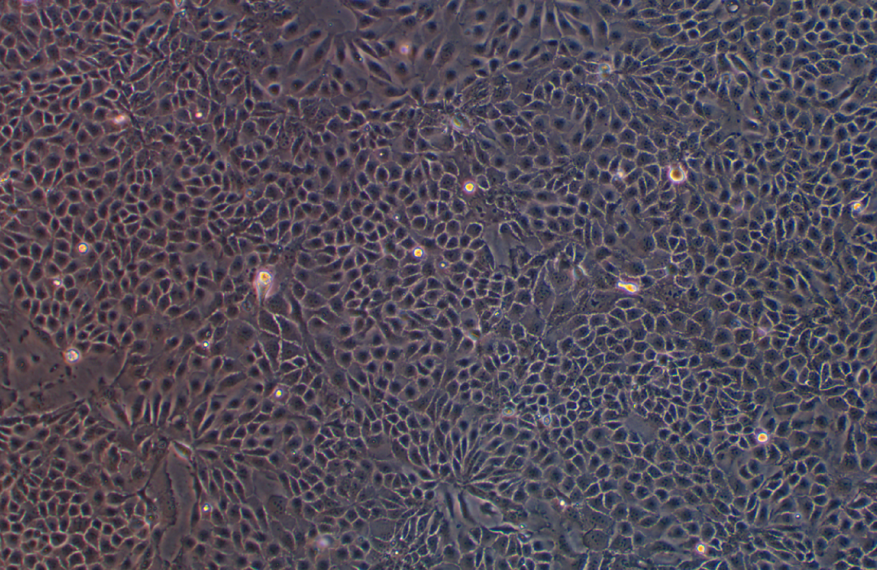 人結腸癌奧沙利鉑耐藥株HCT-8+Oxaliplatin(STR鑒定正確)