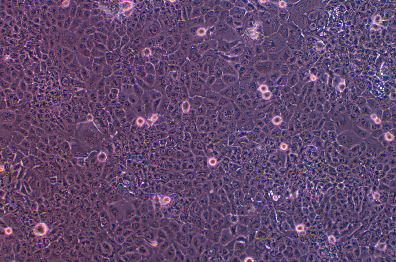人舌鱗癌順鉑耐藥株CAL 27+DDP(STR鑒定正確)