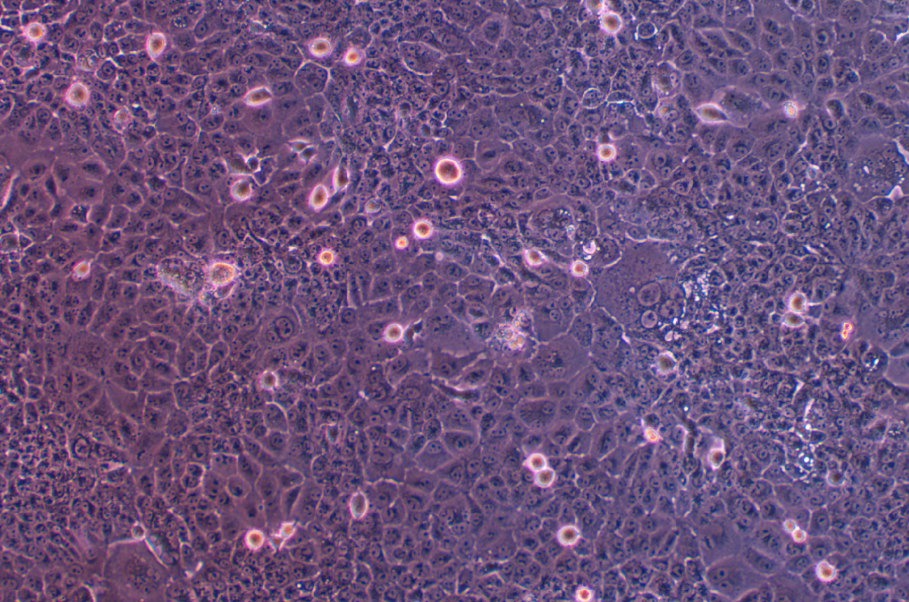 人舌鱗癌順鉑耐藥株CAL 27+DDP(STR鑒定正確)