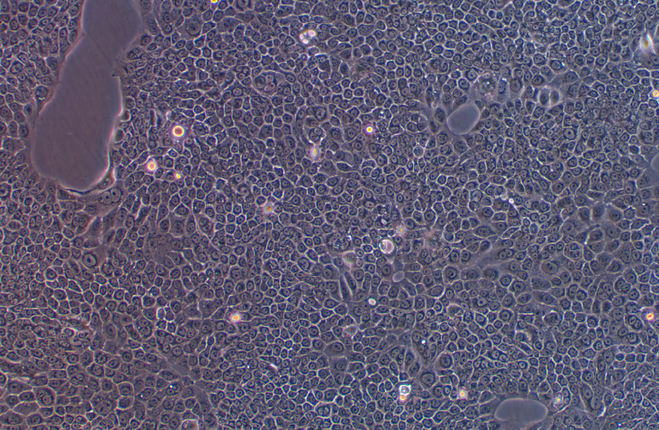 人原位胰腺腺癌細胞BxPC-3(STR鑒定正確)