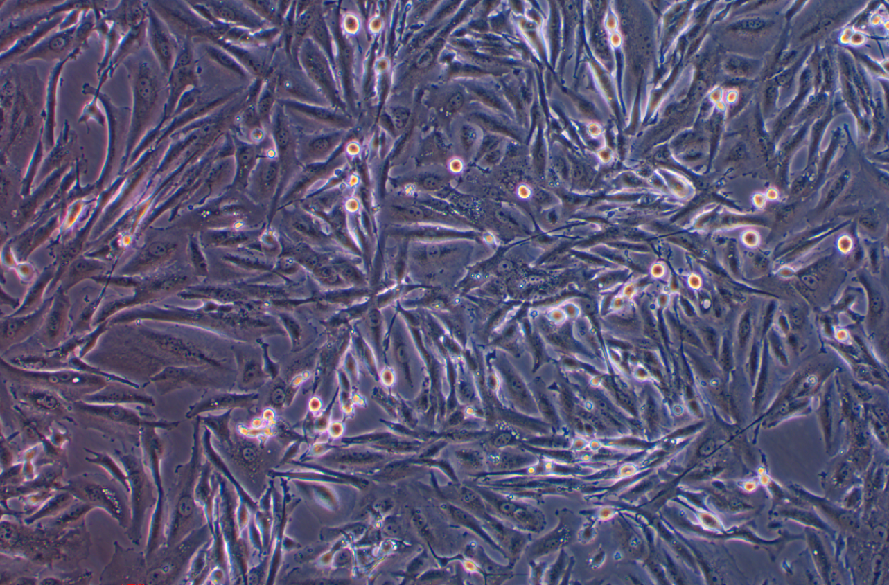 人腦膠質細胞瘤細胞DBTRG-05MG(STR鑒定正確)