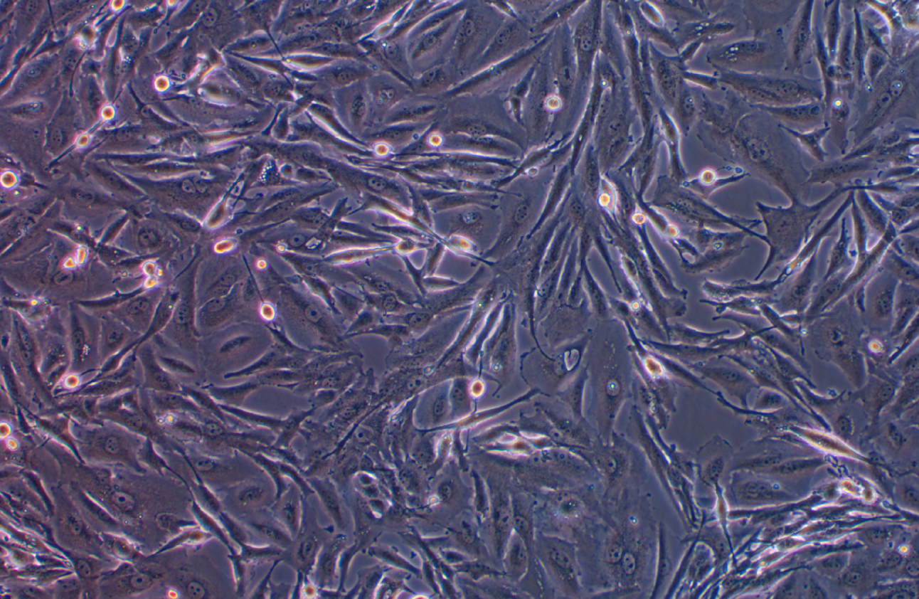 人腦膠質細胞瘤細胞DBTRG-05MG(STR鑒定正確)