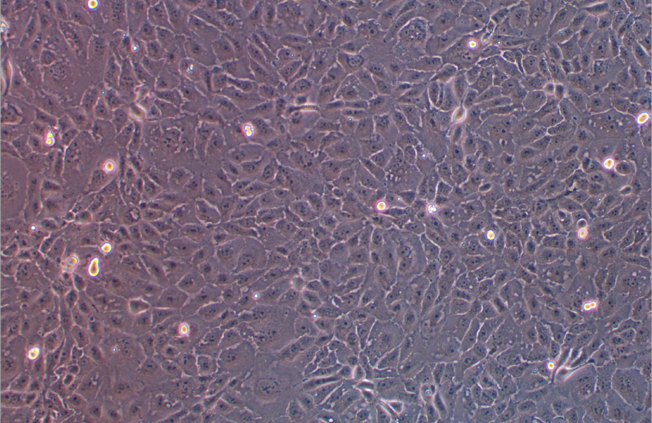 人膽管癌細胞HuCCT1(STR鑒定正確)