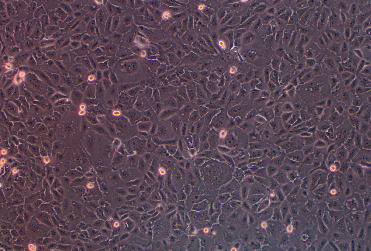 人膽管癌細胞HuCCT1(STR鑒定正確)