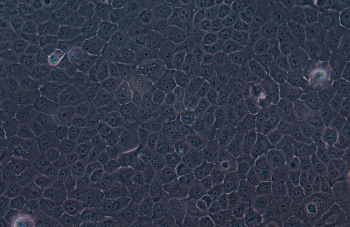 人膀胱鱗癌細(xì)胞SCaBER(STR鑒定正確)