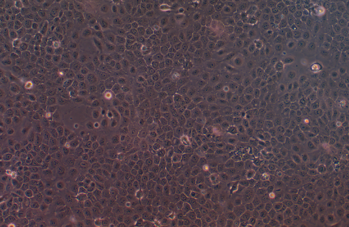 人膀胱鱗癌細(xì)胞SCaBER(STR鑒定正確)