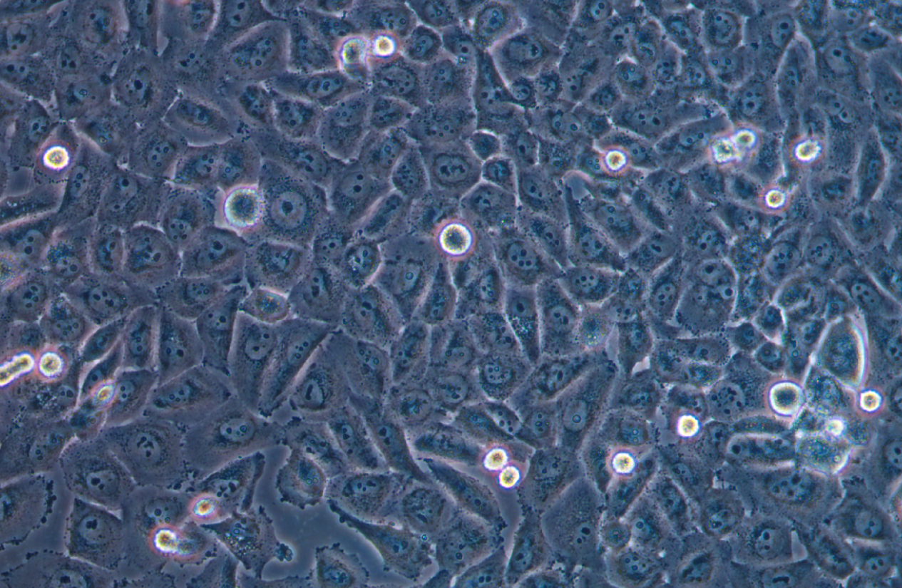 人黑色素瘤細胞MV3(STR鑒定正確)