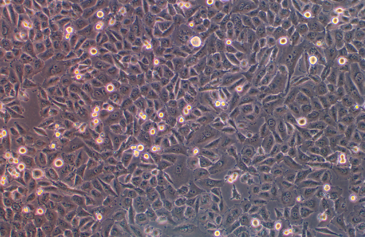 人黑色素瘤細胞MV3(STR鑒定正確)