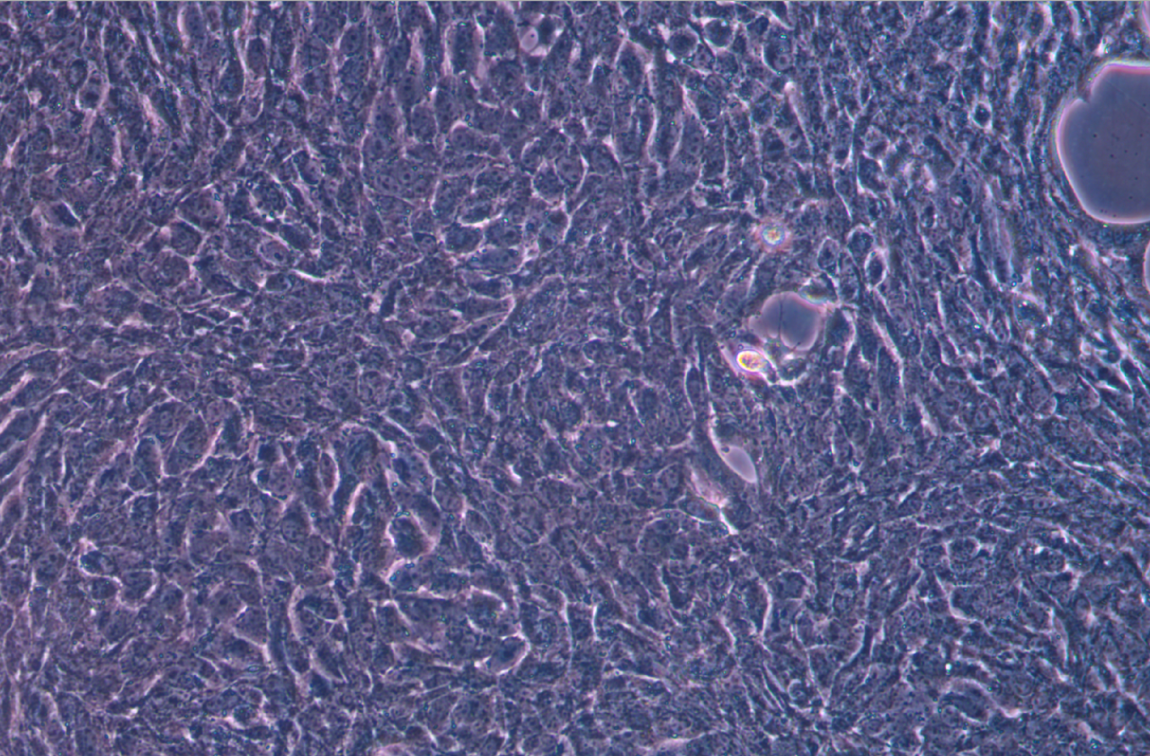 小鼠肝癌細胞 Hep-53.4(STR鑒定正確)