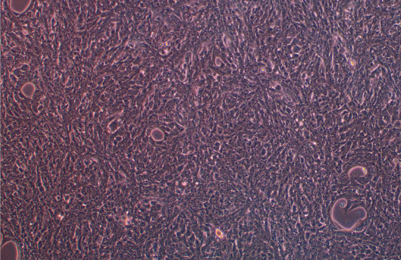 小鼠肝癌細胞 Hep-53.4(STR鑒定正確)