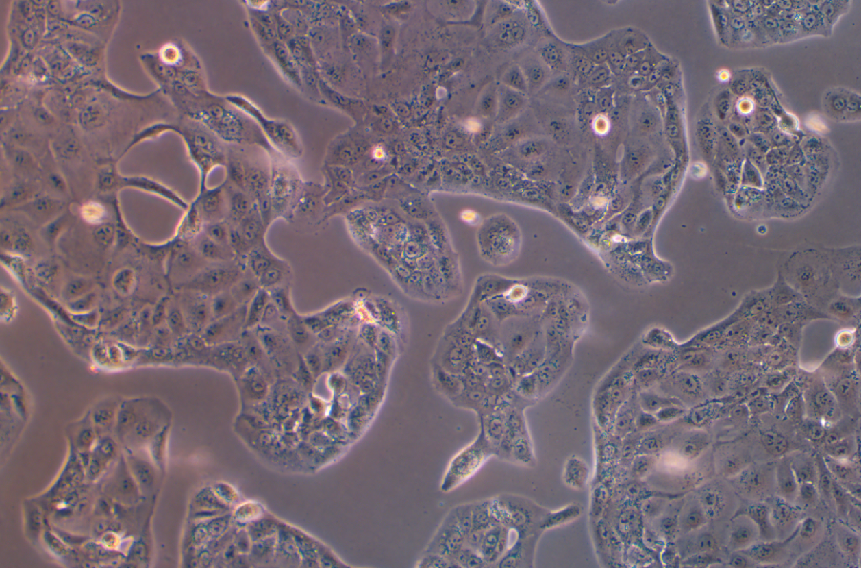 人肺乳頭狀腺癌細胞NCI-H820(STR鑒定正確)